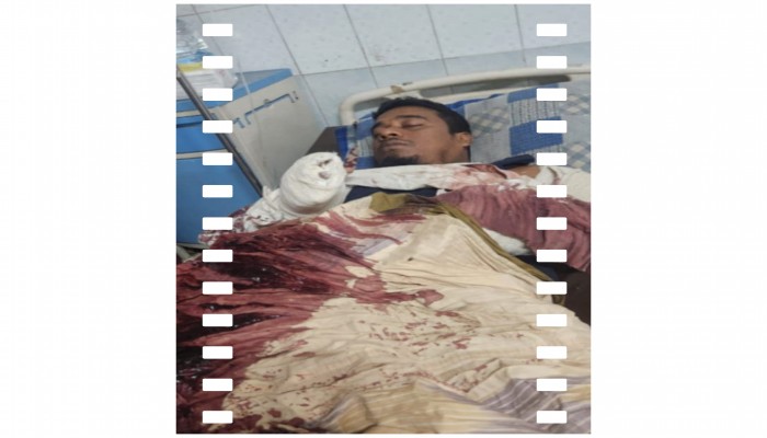 জমি থেকে বালু-পাথর উত্তোলনে বাধা দেয়ায় কৃষককে কুপিয়ে জখম জমি থেকে বালু-পাথর উত্তোলনে বাধা দেয়ায় কৃষককে কুপিয়ে জখম