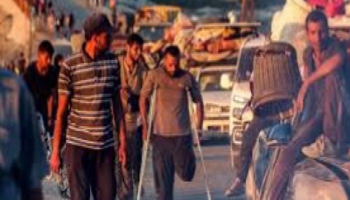 গাজায় ১০ হাজারের বেশি শিশু চিরস্থায়ী শারীরিক ক্ষতির শিকার