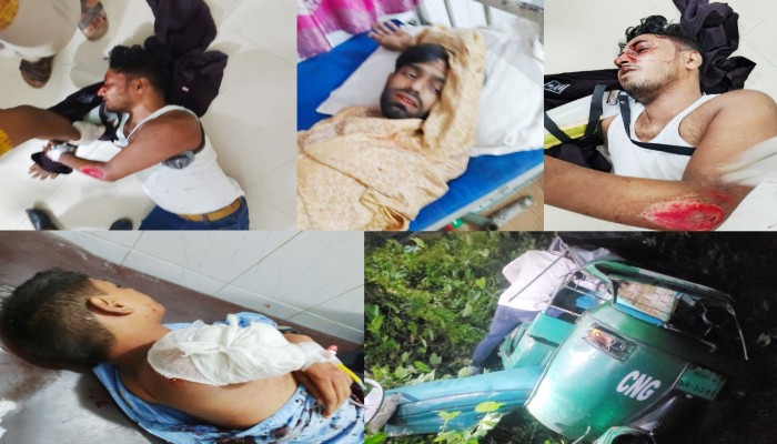 ৫ জন গুরুতর আহত, একজনের হাত দ্বিখন্ডিত