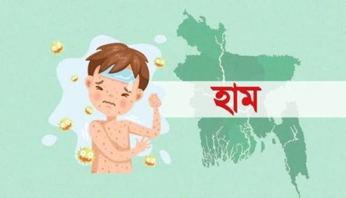 হাম ও হামের উপসর্গে মৃত্যু ৫০০ ছুঁইছুঁই