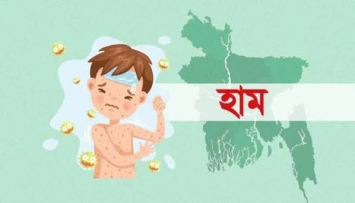 হাম ও উপসর্গে মৃত্যু বেড়ে ৭৬৬