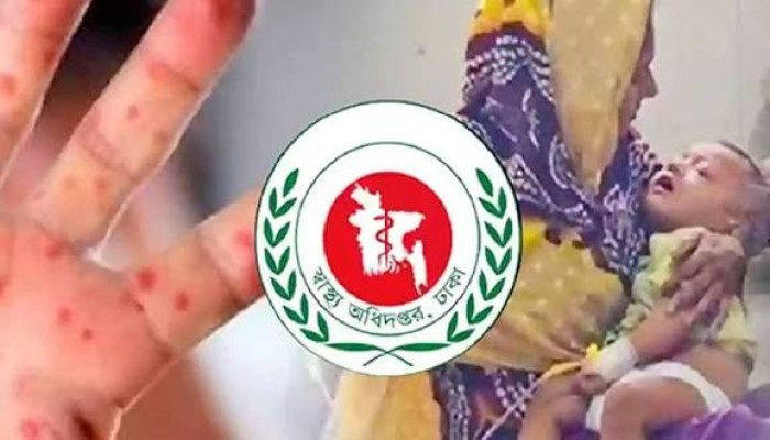 হাম উপসর্গে আরও ৬ মৃত্যু, মোট মৃত্যু ৯০৮