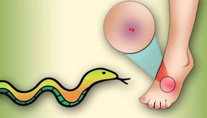 সাপের কামড়ে শিশু আহত