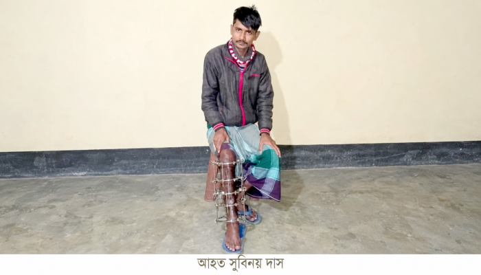 অসহায় মোটরসাইকেল চালক সুবিনয়ের চিকিৎসায় সহায়তার আবেদন