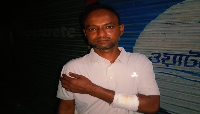 দিরাইয়ে মাদকবিরোধী সভার পর প্রবাসী লিমনের ওপর হামলার অভিযোগ